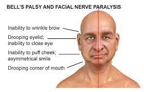 info-image