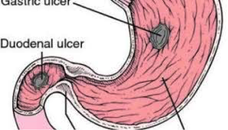 info-image