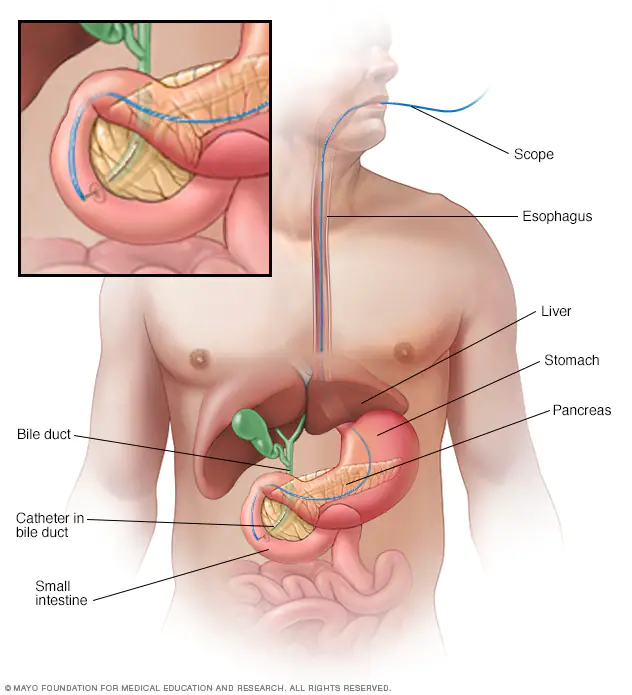 info-image
