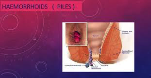 info-image