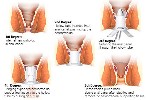 info-image