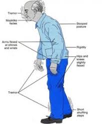 info-image