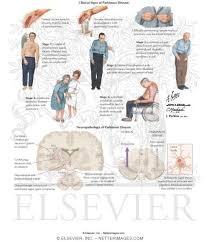 info-image
