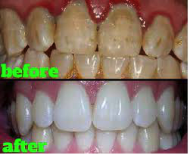info-image