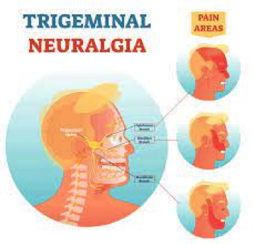 info-image
